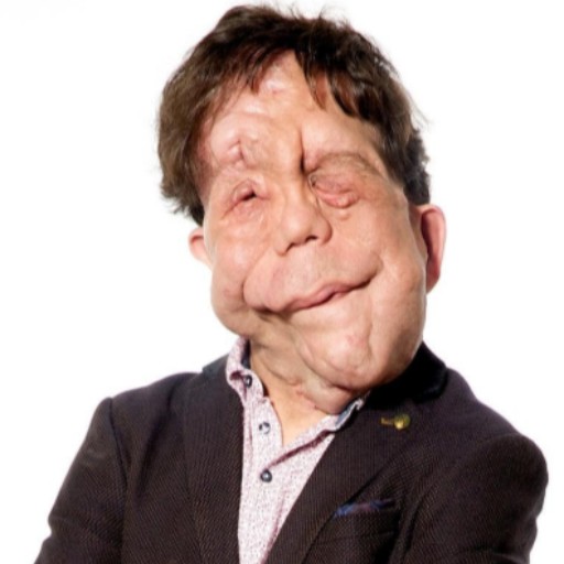 Adam Pearson